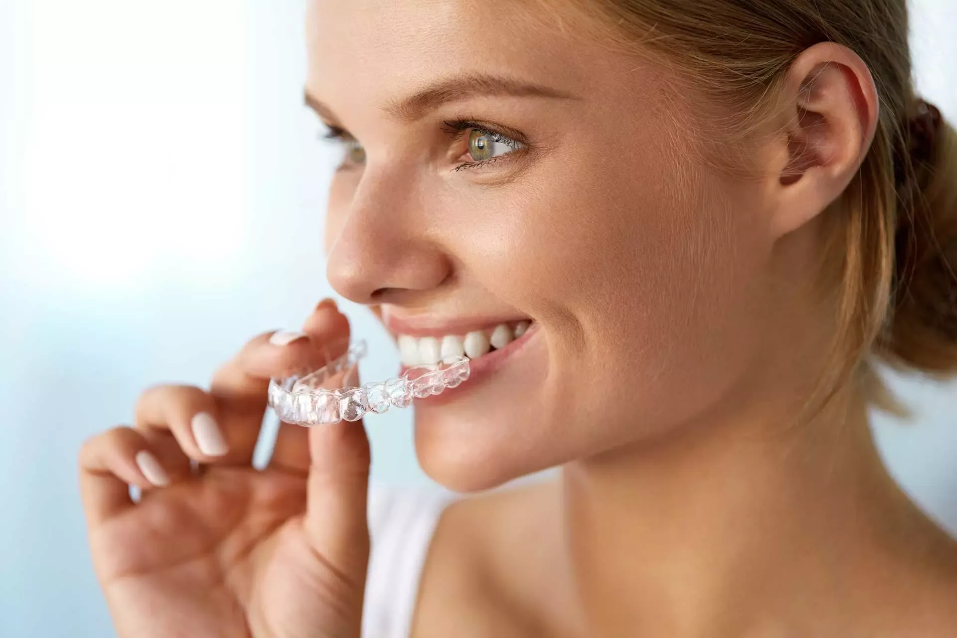 Clear Aligners